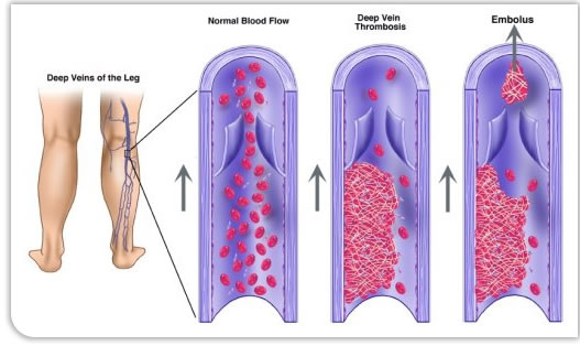 Deep veins of the leg